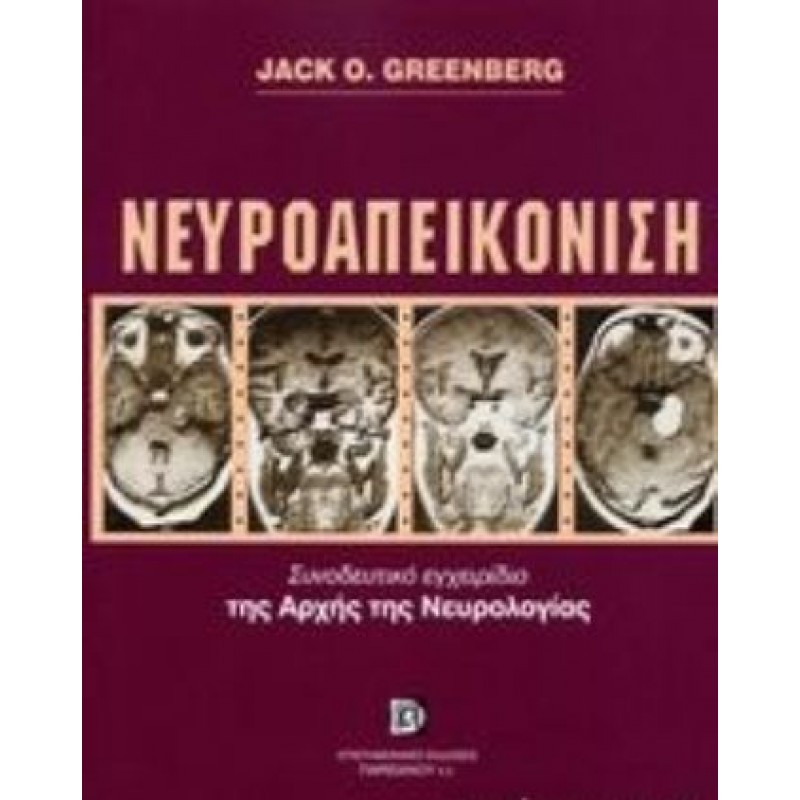 ΝΕΥΡΟΑΠΕΙΚΟΝΙΣΗ, ΣΥΝΟΔΕΥΤΙΚΟ ΕΓΧΕΙΡΙΔΙΟ ΤΗΣ ΑΡΧΗΣ ΤΗΣ ΝΕΥΡΟΛΟΓΙΑΣ 2Ε