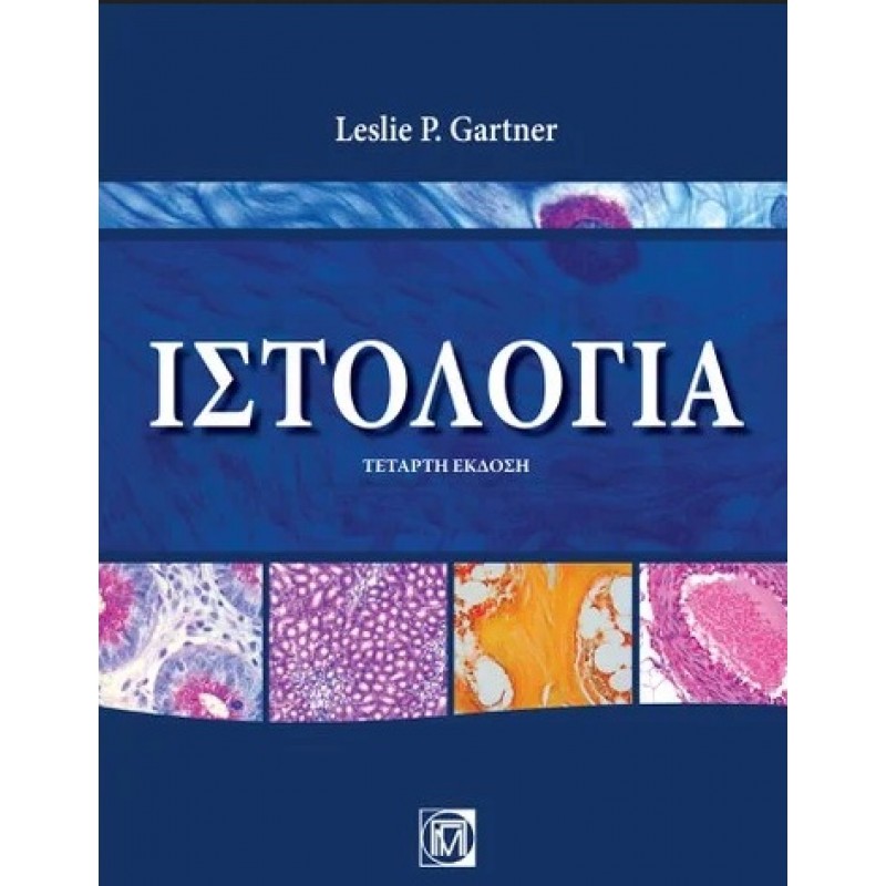 Ιστολογία Gartner, 4Ε