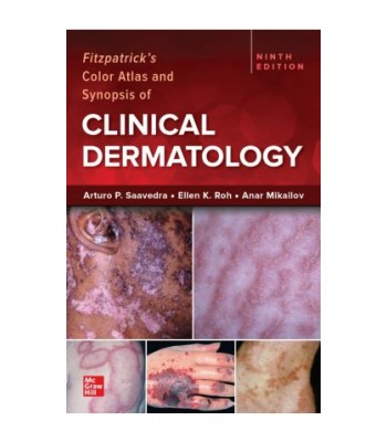 Fitzpatrick’s Color Atlas and Synopsis of Clinical Dermatology, 9th Edition