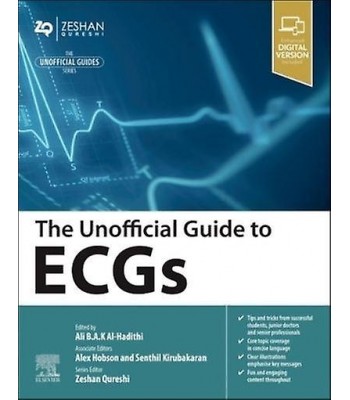 The Unofficial Guide to ECGs