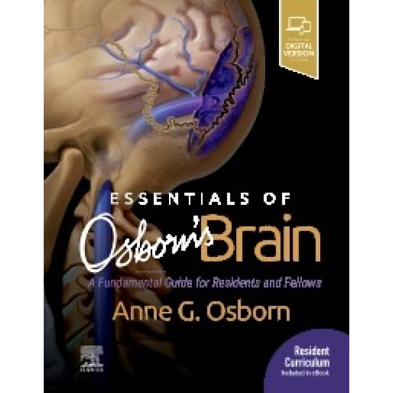 Essentials of Osborn's Brain