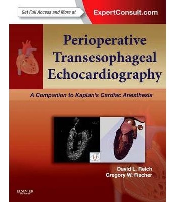 Perioperative Transesophageal Echocardiography