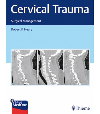 Cervical Trauma Surgical Management 