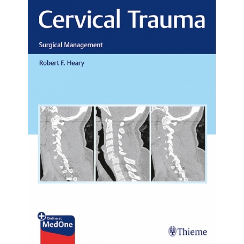 Cervical Trauma Surgical Management 