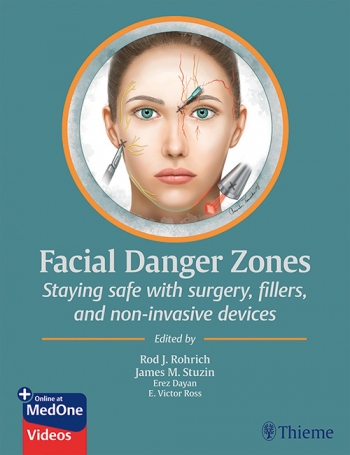 Facial Danger Zones 日本語版（フェイシャルデンジャーゾーン