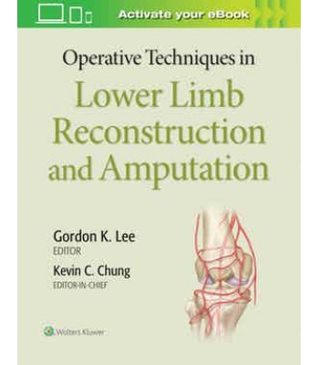 Operative Techniques in Lower Limb Reconstruction and Amputation