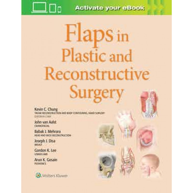 Flaps in Plastic and Reconstructive Surgery 1st edition