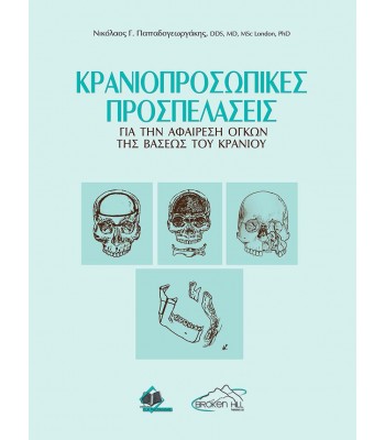Κρανιοπροσωπικές Προσπελάσεις για την Αφαίρεση Όγκων της Βάσεως του Κρανίου