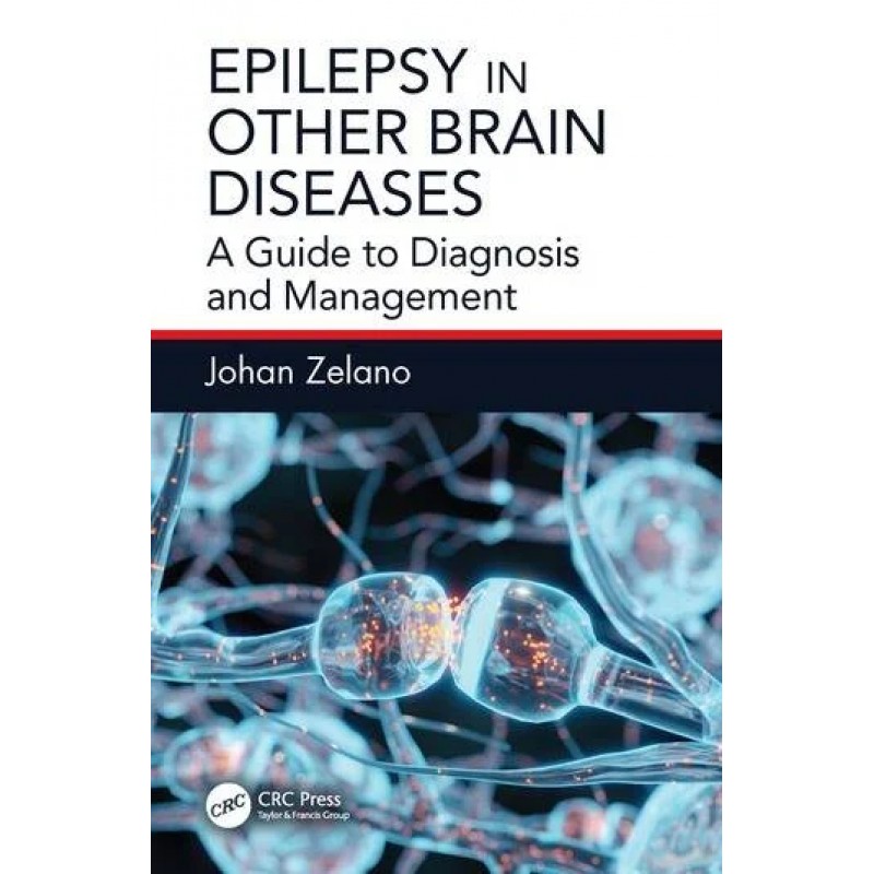 Epilepsy in Other Brain Diseases A Guide to Diagnosis and Management