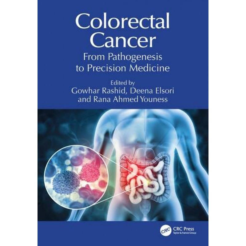 Colorectal Cancer From Pathogenesis to Precision Medicine