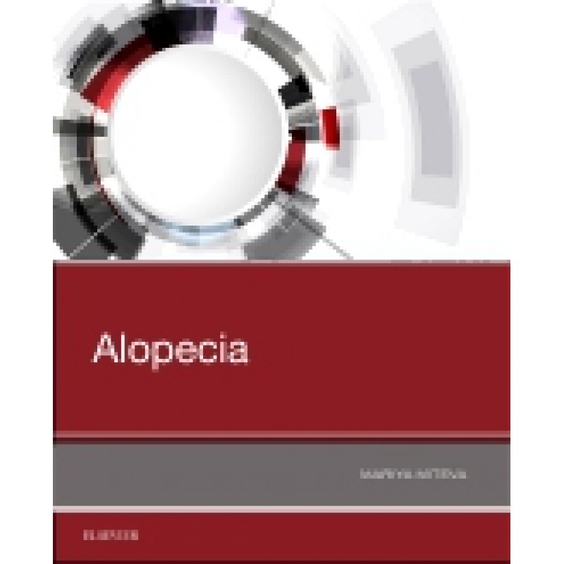 Alopecia