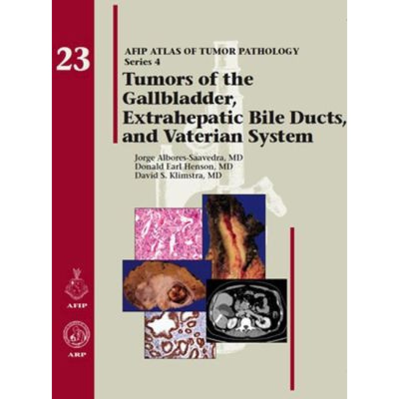 Tumors of the Gallbladder, Extrahepatic Bile Ducts, and Vaterian System