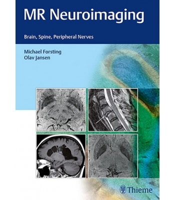 MR Neuroimaging Brain, Spine, and Peripheral Nerves