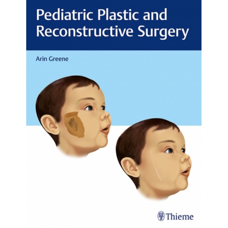 Pediatric Plastic and Reconstructive Surgery