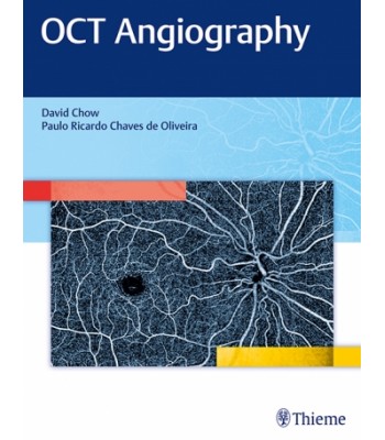 OCT Angiography