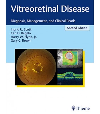 Vitreoretinal Disease Diagnosis, Management, and Clinical Pearls 2nd Edition