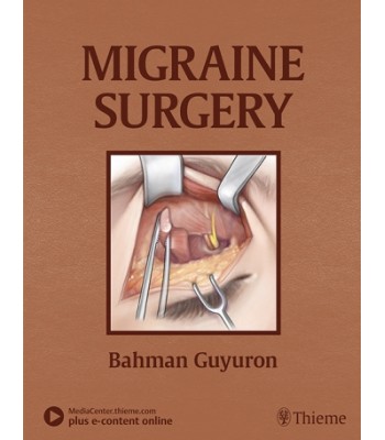 Migraine Surgery