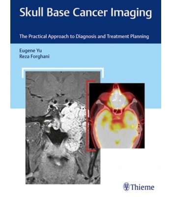 Skull Base Cancer Imaging The Practical Approach to Diagnosis and Treatment Planning