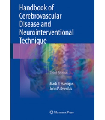Handbook of Cerebrovascular Disease and Neurointerventional Technique 3rd Edition