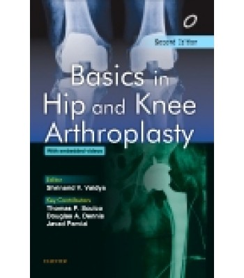 Basics in Hip and Knee Arthroplasty, 2nd Edition