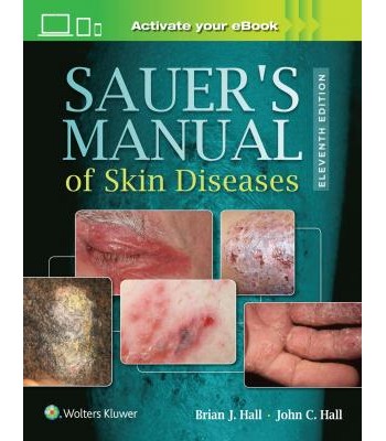 Sauer's Manual of Skin Diseases, 11e