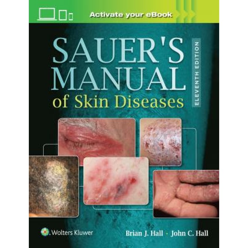 Sauer's Manual of Skin Diseases, 11e