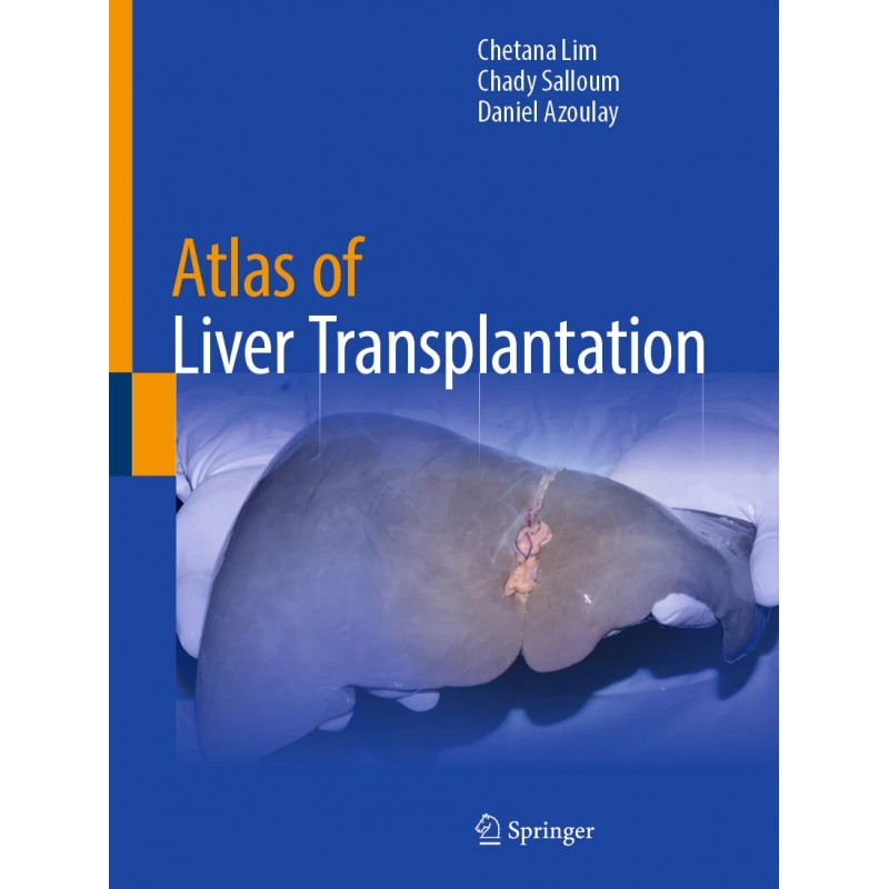 Atlas of Liver Transplantation
