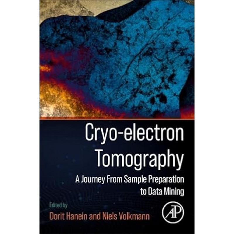 Cryo-electron Tomography: A Journey from Sample Preparation to Data Mining