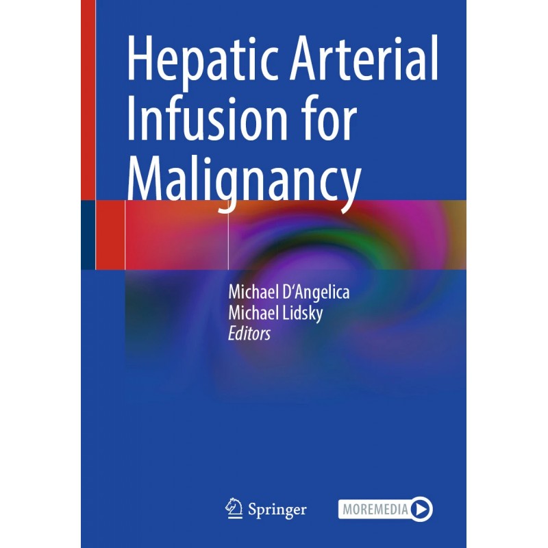 Hepatic Arterial Infusion for Malignancy