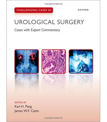 Challenging Cases in Urological Surgery (Cases with Expert Commentary)