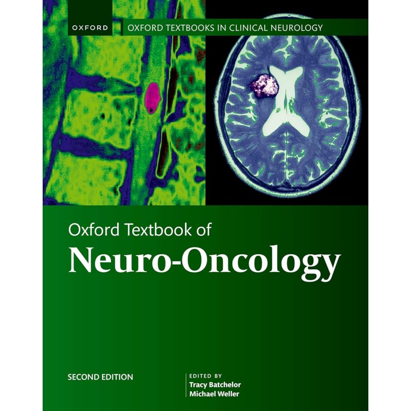 Oxford Textbook of Neuro-Oncology Second Edition