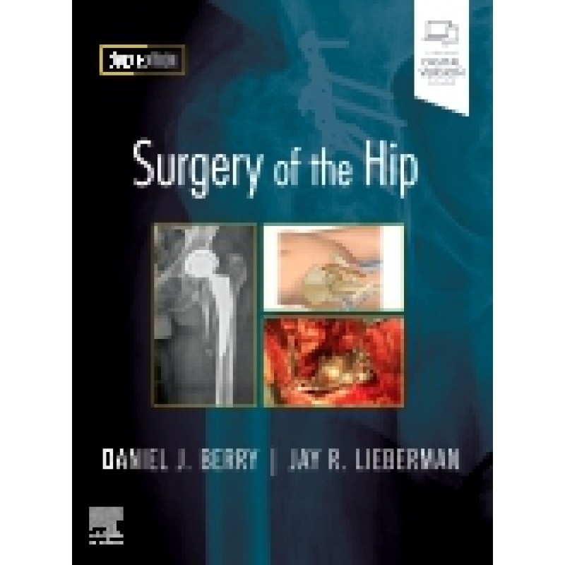 Surgery of the Hip, 2nd Edition