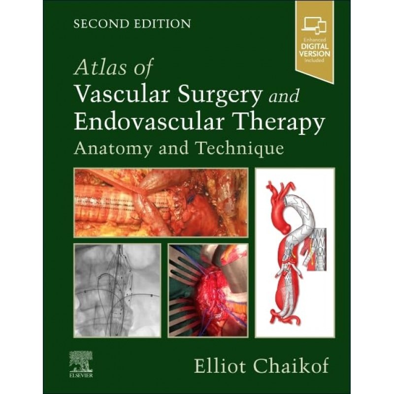 Atlas of Vascular Surgery and Endovascular Therapy, 2nd Edition. Anatomy and Technique