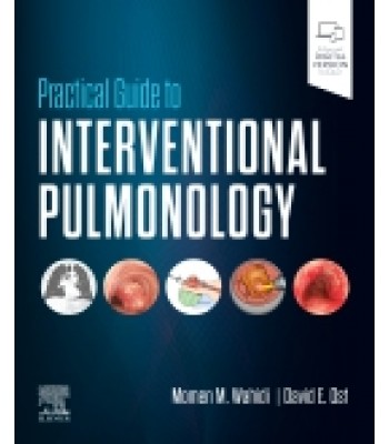 Practical Guide to Interventional Pulmonology