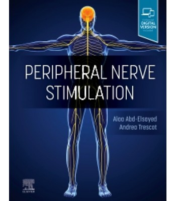 Peripheral Nerve Stimulation: A Comprehensive Guide