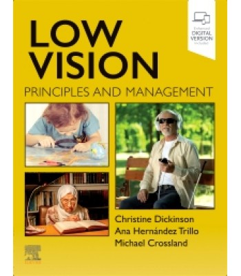 Low Vision: Principles and Management