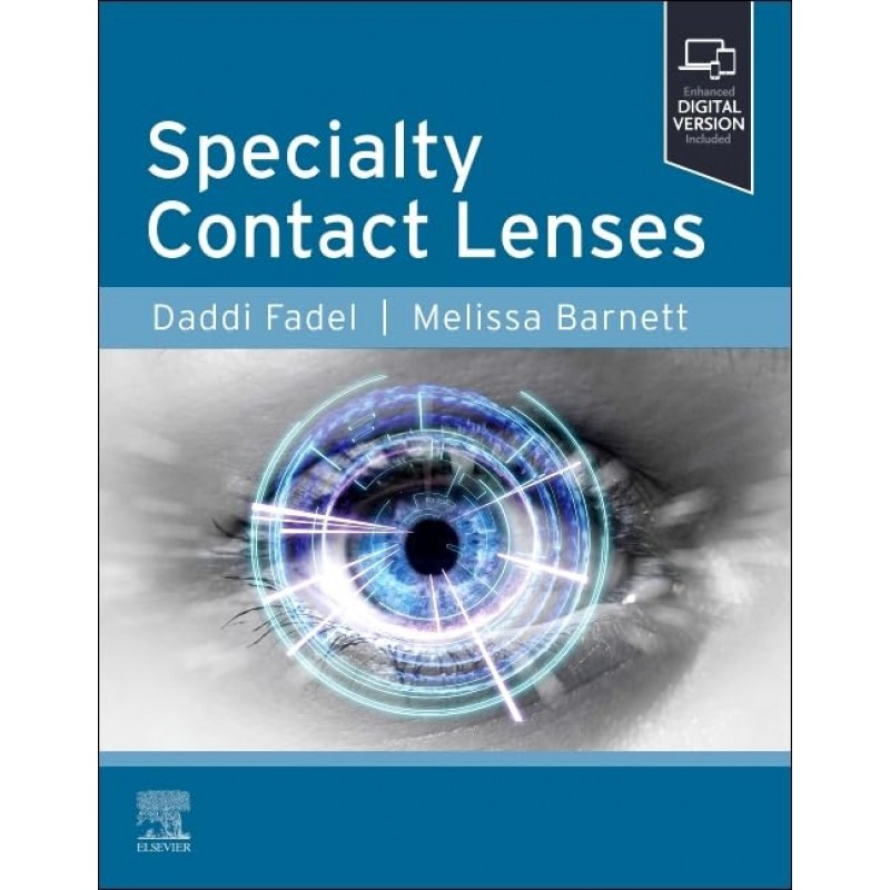 Specialty Contact Lenses, 1st Edition