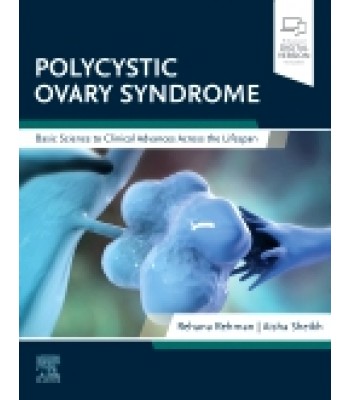 Polycystic Ovary Syndrome