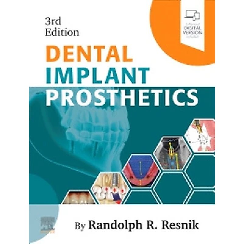 Dental Implant Prosthetics, 3rd Edition