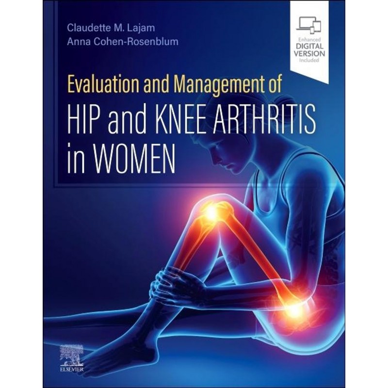 Evaluation and Management of Hip and Knee Arthritis in Women, 1st Edition