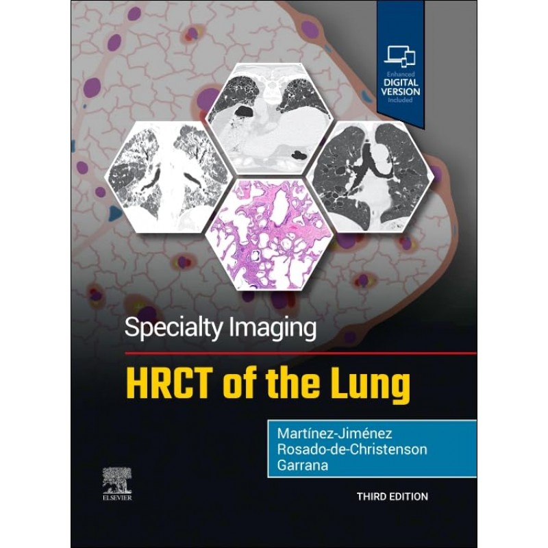 Specialty Imaging: HRCT of the Lung, 3rd Edition
