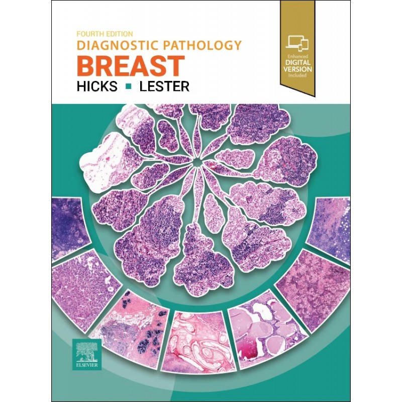 Diagnostic Pathology: Breast, 4th Edition