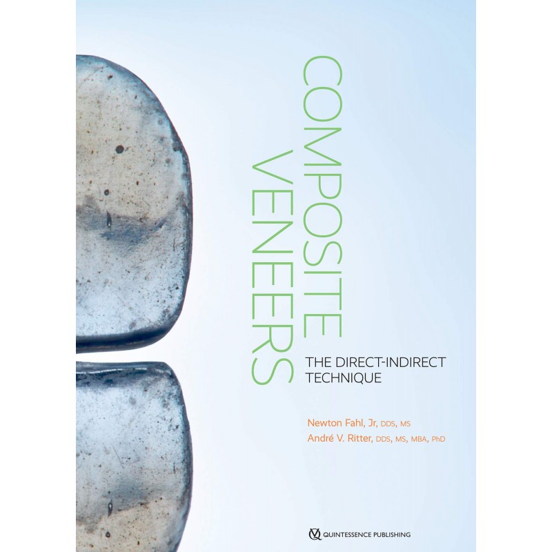 Composite Veneers 