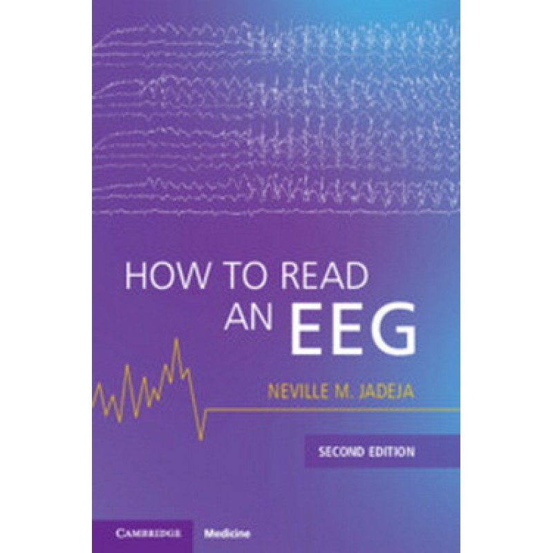How to Read an EEG 2nd Edition