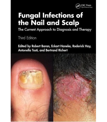 Fungal Infections of the Nail and Scalp. The Current Approach to Diagnosis and Therapy 3rd Edition