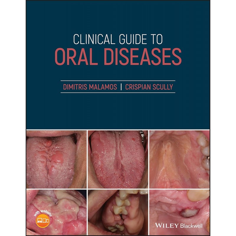 Clinical Guide to Oral Diseases