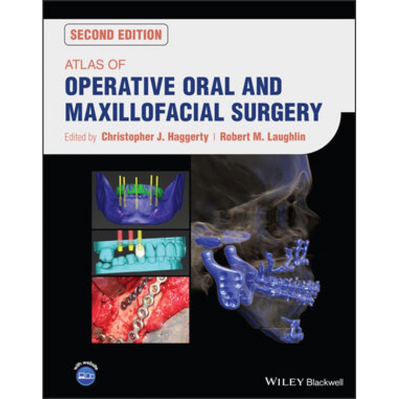 Atlas of Operative Oral and Maxillofacial Surgery, 2nd Edition