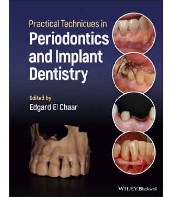 Practical Techniques in Periodontics and Implant Dentistry