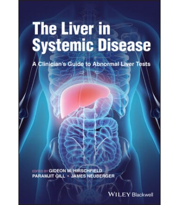 The Liver in Systemic Disease: A Clinician’s Guide to Abnormal Liver Tests