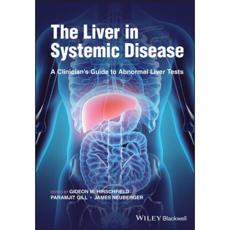 The Liver in Systemic Disease: A Clinician’s Guide to Abnormal Liver Tests